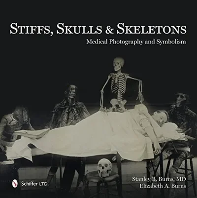 Stiffs, Skulls & Skeletons: Medical Photography and Symbolism (UK) — dewey-pub:Schiffer